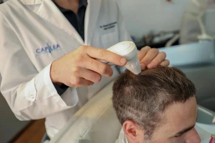 Caída del cabello: los mitos que tenés que dejar de creer