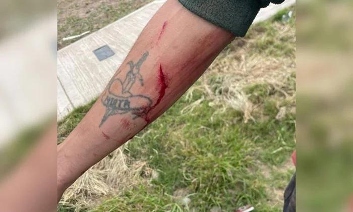 Hombre herido al defender a su pareja de un ataque armado