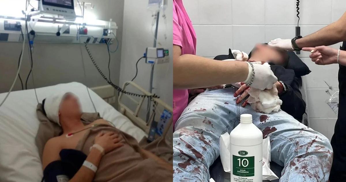 Grave ataque a una pareja en Tucumán: investigan posible móvil homofóbico