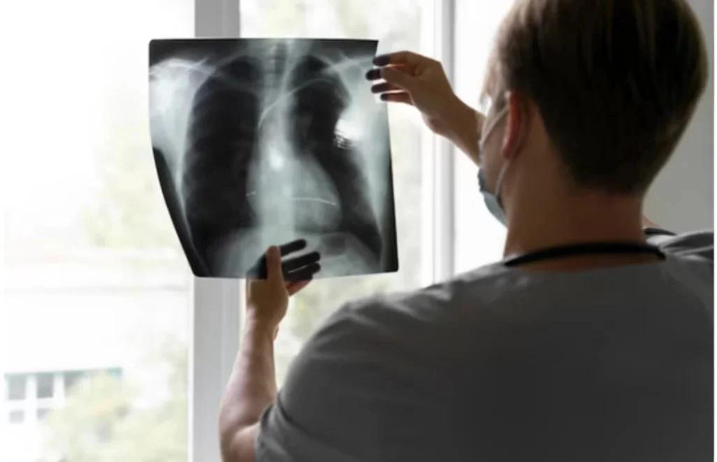 Derrame pleural: qué es y cómo detectarlo