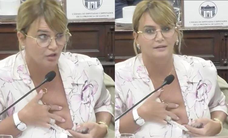 Amalia Granata mostró las secuelas de una intervención médica ante críticas