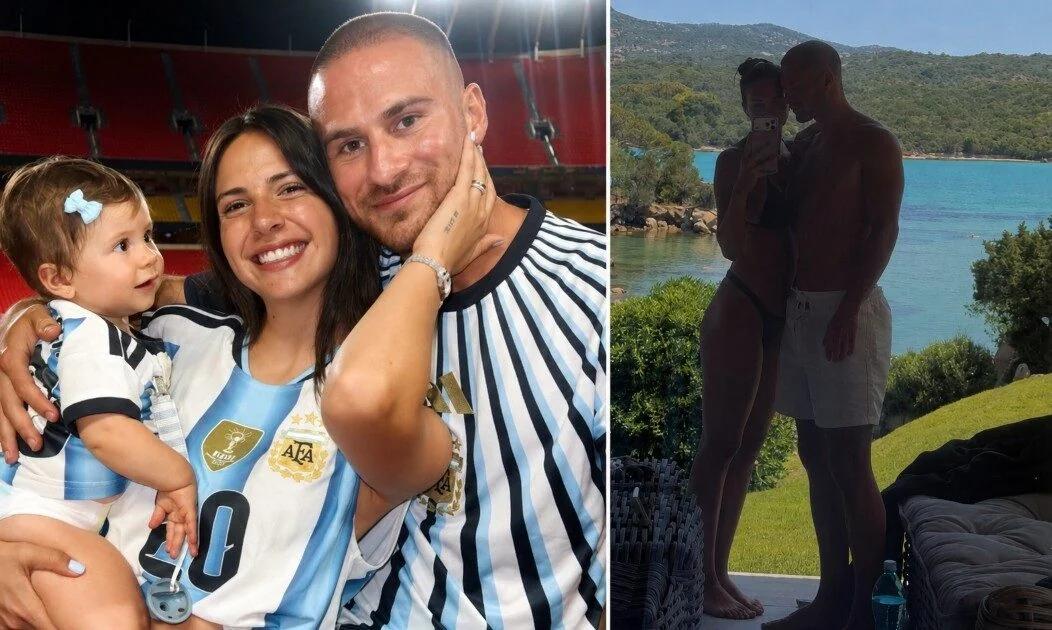 ¡Impresionante! Así quedó Alexis Mac Allister tras someterse a un polémico retoq